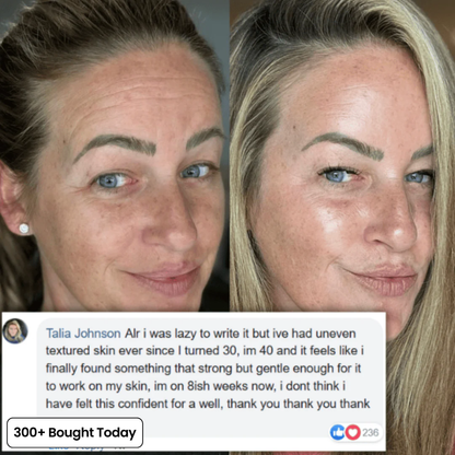 All-in-One Roller Massage Cream 🧴 Collagen & Hyaluronic Acid | Firm, Lift & Smooth Skin from Neck to Body